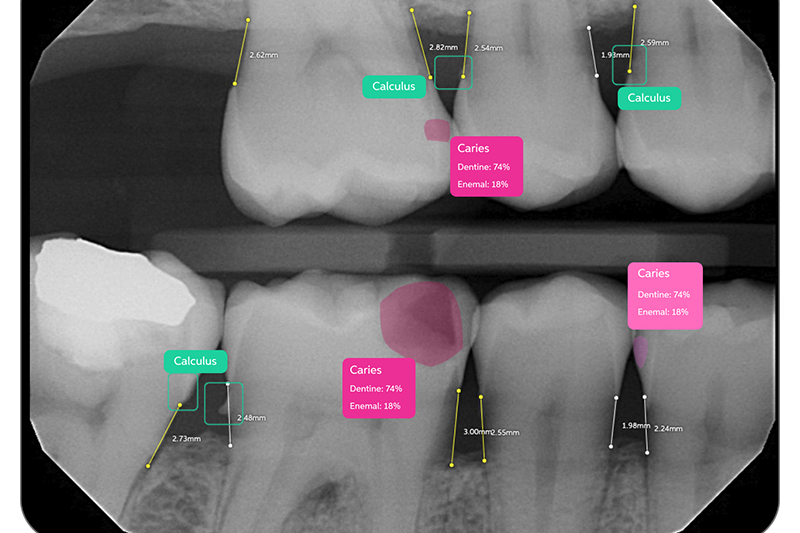 Diode Laser in Commack